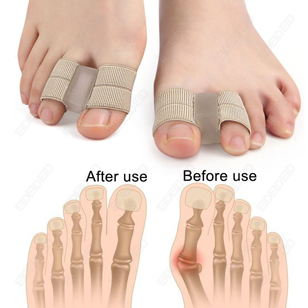 Bunyon ayak parmağı Düzeltici  - Women'S Shoes For Bunions incelemesi ve fiyatı